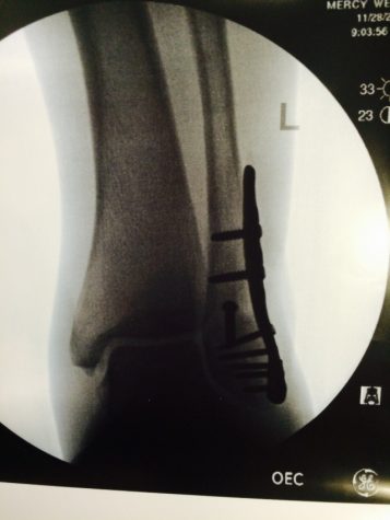 X-Ray of Masminsters leg