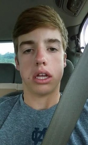 Duncan Kelley fresh out of surgery